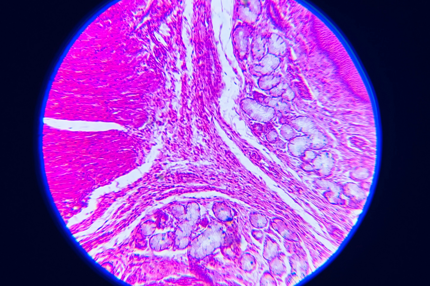 Bacterial Vaginosis: Causes, Symptoms & How To Treat It